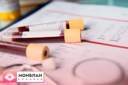 Биохимия и результаты анализа на наркотики